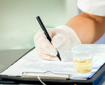 Synthetic Urine Quality Control: Ensuring Accurate Health Diagnostics